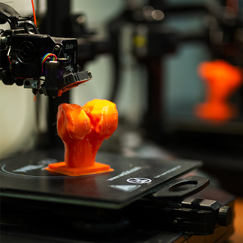 Total Knee Replacement