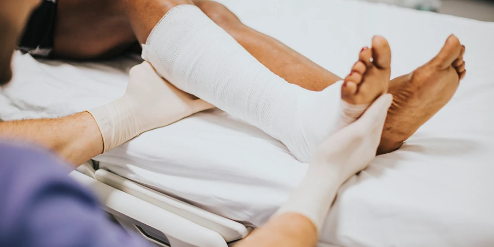 Fracture Management Treatment, Recovery & Healing Time