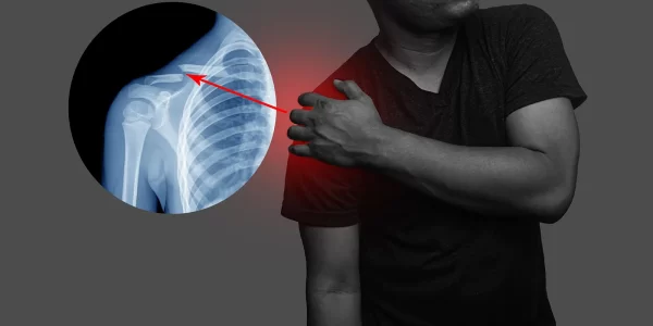 shoulder-arthroscopy-bnr Shoulder Arthroscopy images