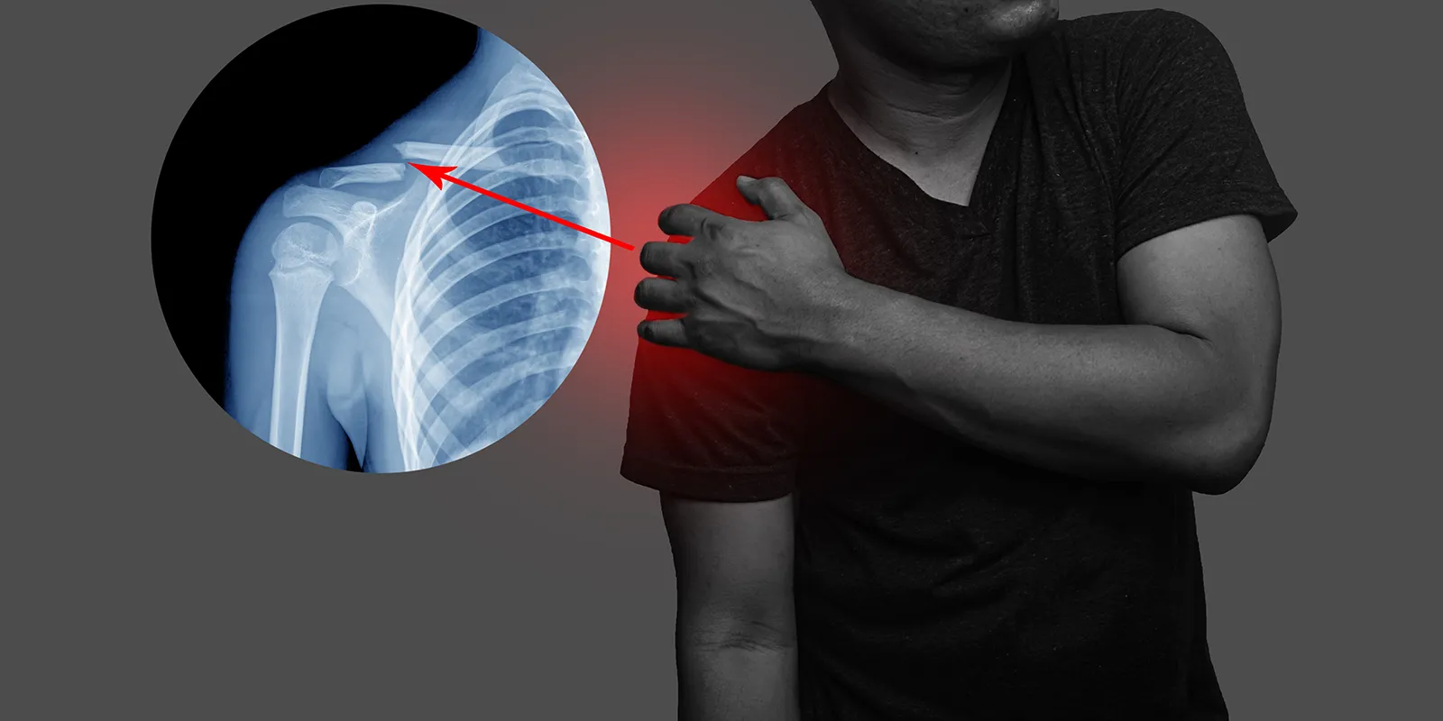 Shoulder Arthroscopy images